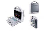 Buy cheap Digital Color Doppler Machine Laptop Ultrasound Scanner Diagnostic Color System from wholesalers