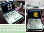 Buy cheap mobile Digital Ultrasound Scanner Equipment Portable diagnostic machine from wholesalers