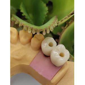 Buy cheap Cemented Solution NOBEL BIOCARE Dental Implants Crown product