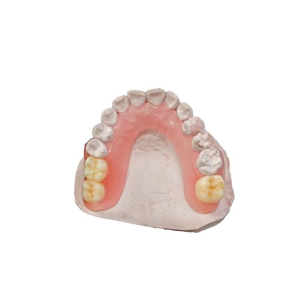 Precision Customization Planting Model Resin With 3D Scanning And Printing