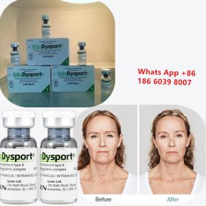 Botulinum Toxin Type A Dysport Injection for Wrinkle Reduction