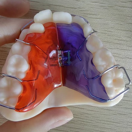 Buy cheap Smooth Surface Plastic Implantation Scenarios for Customized Solutions from wholesalers