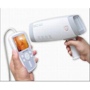 High-Resolution Imaging Digital electronic Colposcope Handheld Video Colposcope