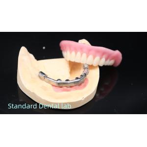 Buy cheap Titanium Implant Supported Dentures Precise Ivoclar Denture Over Implants product