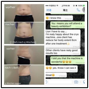 Buy cheap Hot selling high quality CE approval  Cryolipolysis Slimming machine from wholesalers