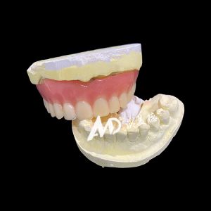 Removable Denture Full Acrylic Denture Suitable for Various Dental Applications