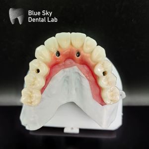 Buy cheap Customized Full Mouth Implant Case Universal Compatibility from wholesalers
