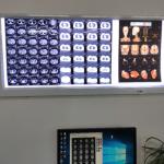 Buy cheap Kefu Diagnostic Imaging Medical X Ray Film Fuji Agfa Hq Lucky Printer 210 Microns from wholesalers