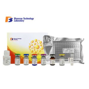 Buy cheap Laboratory Research Human ELISA Kit YKL-40 CHI3L1 Enzyme - Linked Immunosorbent Assay Kit Customized from wholesalers