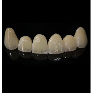 Buy cheap Comfortable Zirconia Crown With Good Fitting And Precision Esthetics from wholesalers
