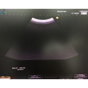 China Hitachi EUP-C715 Abdominal Ultrasound Probe Imaging Diagnosis on sale