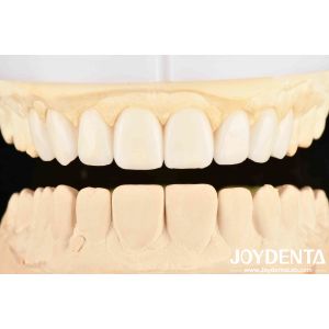 Dental's Good Elasticity And Tooth Arrangement Technology Flexible Denture