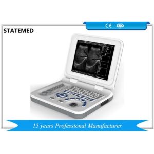 Buy cheap Medical Pregnancy Test Mobile Ultrasound Machine With Convex Probe Standard from wholesalers