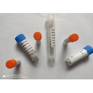 Buy cheap Recombinant Rabbit Antibody (2019-NCoV) Spike Neutralizing Antibody, Rabbit Antibody from wholesalers