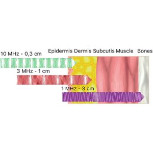 Buy cheap LDM Dual Frequency Skin Care Machine Ultrasound Hydra Facial Rejuvenation from wholesalers