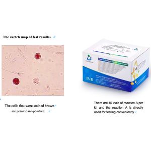 Semen Sample Leukocytes Test Kit 40T/Kit For Male Reproductive Tract Infection