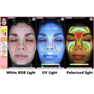 Buy cheap UV RGB Light Facial Skin Analysis BS-3200 Skin Analyzer from wholesalers