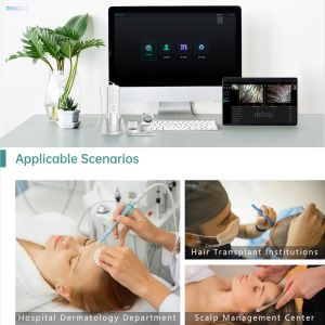 Buy cheap Customizable Scalp Analysis Machine For Dryness And Dandruff Problem from wholesalers