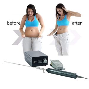 Buy cheap Plastic Surgery Liposuction Electric Vibration Device 300W from wholesalers