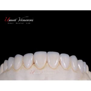Buy cheap Ultra thin porcelain veneer from wholesalers