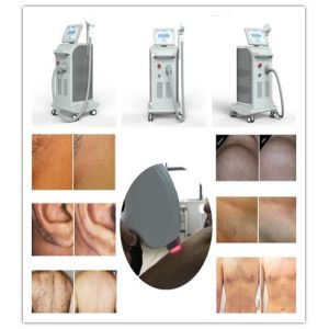 Nubway best painless high technology 808 soprano diode laser hair removal