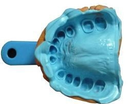 Fast Setting Addition Silicone Dental Impression Material Amazing Mold Putty