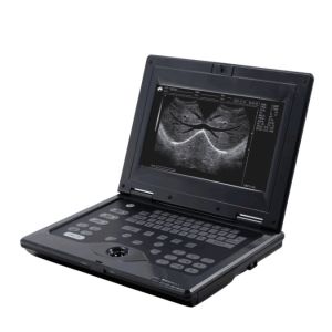 Buy cheap CLS5800 laptop Veterinary Ultrasound Scanner Full Digital Ultrasonic Diagnostic System from wholesalers