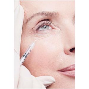 Hyaluronic Acid Injection Dermal Filler Remove Eye Bags And Dark Circles