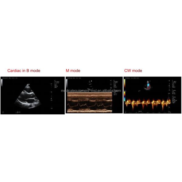 Hospital 4D Color Doppler Ultrasound Echo Machine MSLCU46 With Touch Screen