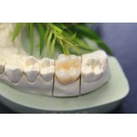 Buy cheap Design Dental Lab Monolithic Zirconia Dental Crown For Molars Posterior Teeth product