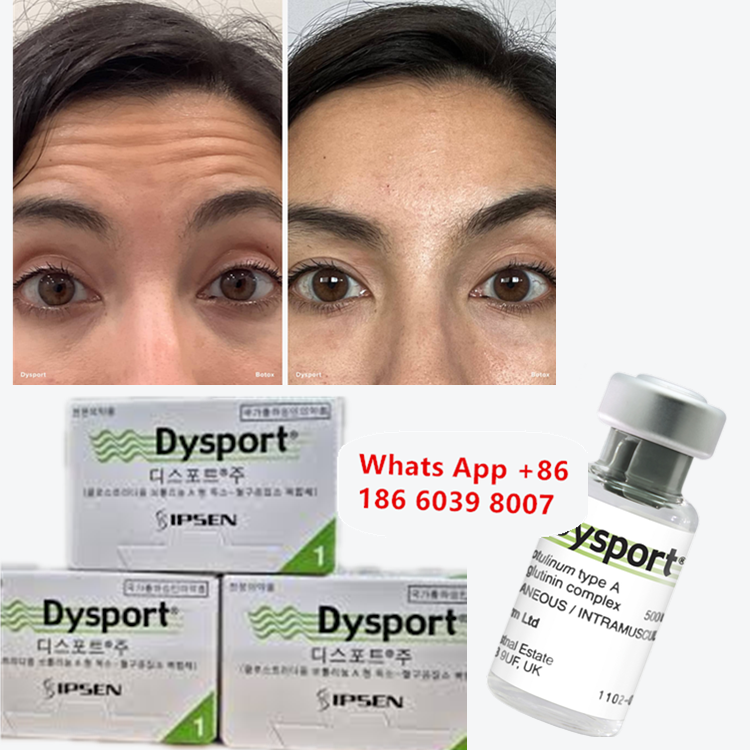 Buy cheap Dysport Botulinum Toxin Type A for Frown and Glabellar Lines from wholesalers