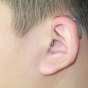 Vigor 403 Bluetooth Programmable Hearing Aid Mild To Moderate Hearing Loss