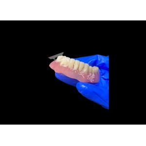 Buy cheap Lightweight Full Acrylic Denture With Metal Framework , Full Arch Removable product