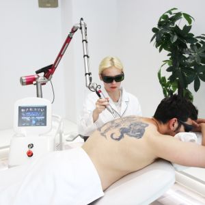 Buy cheap OEM ODM Custom Picosecond Laser Tattoo Removal Machine With 15 Inch Color Touch Screen from wholesalers