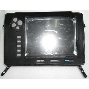 Buy cheap Palm Ultrasound ScannerSU-V5(ultrasonic,black white,Imaging System) from wholesalers