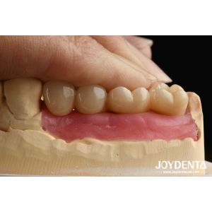 Buy cheap Ultra-precision processing Zirconia Implants All-Zirconium Integrated Crown product