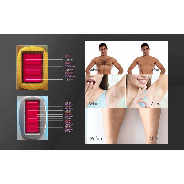 Stationary Q Switched Nd Yag Laser Machine Professional Pico Laser Tattoo Removal Machine 808nm