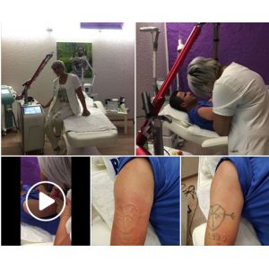 Buy cheap Yag Laser Skin Care Pigmentation Removal Machine With 1064nm And 532nm Wavelength from wholesalers