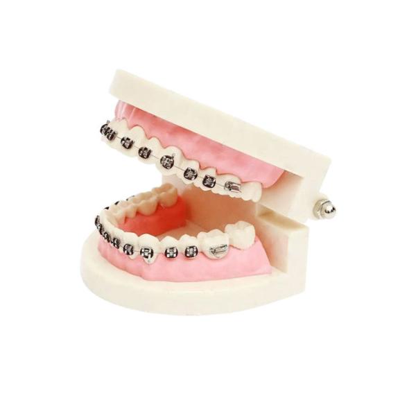 Buy cheap Porcelain Dental Crown Acid And Alkali Resistance Good Biocompatibility from wholesalers