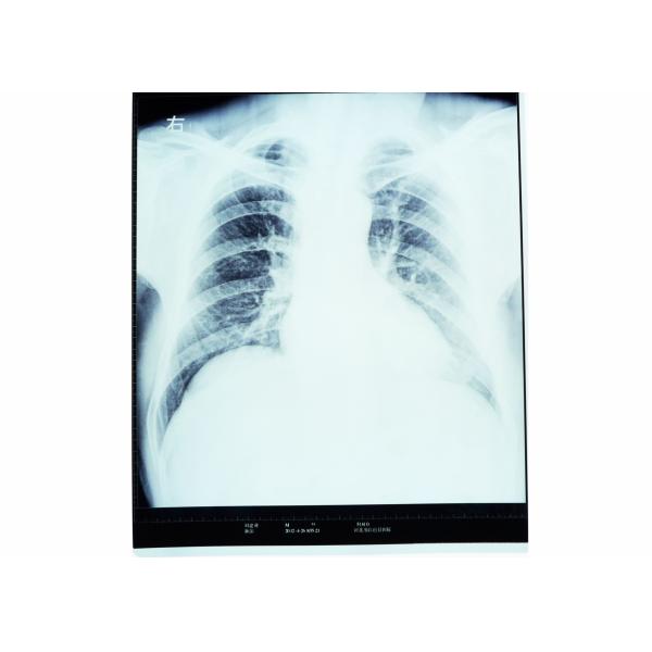 Quality High Sharpness Medical Diagnostic Imaging , Dry AGFA X Ray Film for sale