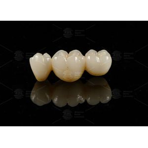 Screw Retained Titanium Custom Abutment Porcelain Fused To Zirconia