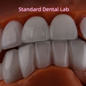 Buy cheap Lithium Dicilicate layer Ivoclar Emax Zirconia Laminate Veneers Translucent OEM product