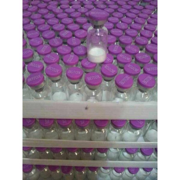 Botox Injections Anti-wrinkle Effect Is Good