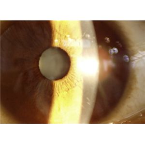 Buy cheap Handheld Slit Lamp 16G Digital Fundus Camera 80000 Images from wholesalers