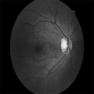 Buy cheap FAF Non Mydriatic Fundus Camera Optical Retinal Imaging from wholesalers