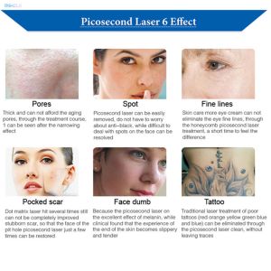 Buy cheap 1064nm Picosecond Laser Machine PICO Easy Operation Pico Pulse Machine from wholesalers