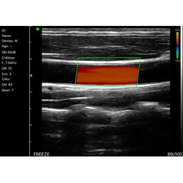 Pocket Wireless Ultrasound Probe Handheld Ultrasound Probe Mini Ultrasound Only 235g Weight 128 Elements 2.4G Wifi 3