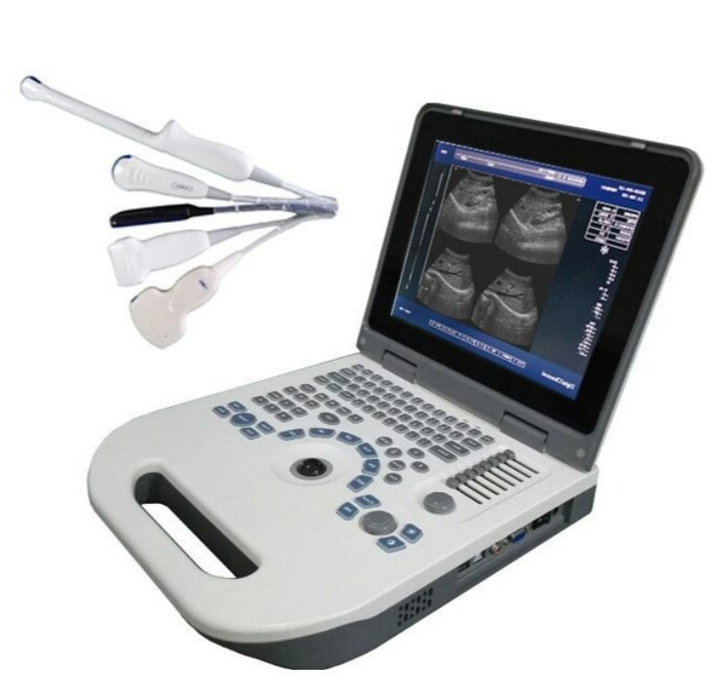 Buy cheap ISO Electron Scan Notebook USG Scan Machine For Obstetrics And Gynecology from wholesalers