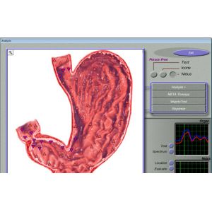 Buy cheap Quantum 3d Nls Health Analyzer , Non-linear Analysis System from wholesalers