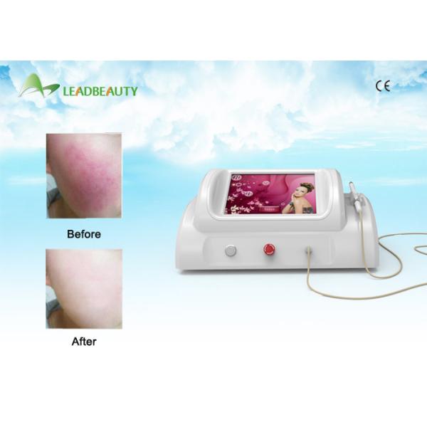 Quality New Technology Rbs Vascular Removal / Spider Veins Removal Rbs Vascular for sale